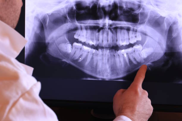 Best Emergency Dentist for Lost Fillings or Crowns in Walnut Cove, NC