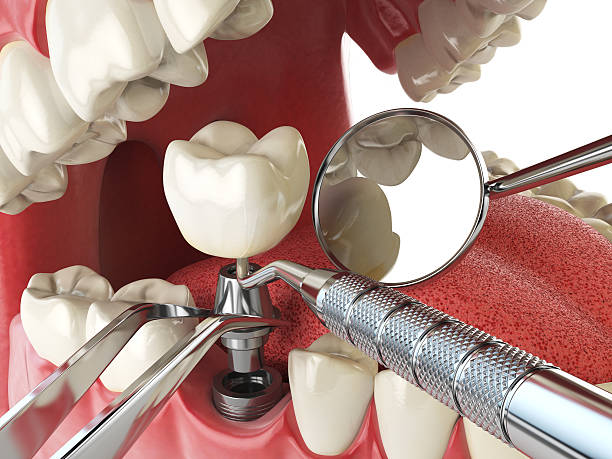 Best Emergency Dental Extractions in Walnut Cove, NC